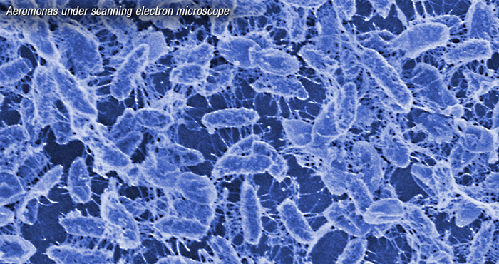 Understanding how strains of flesh-eating bacteria interact may be key to treatment