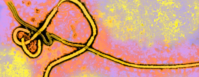 UTMB collaboration results in rapid Ebola test