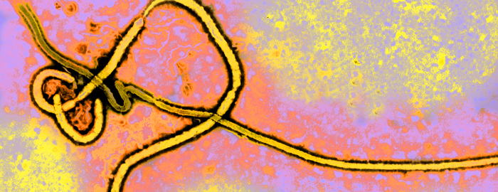 UTMB researchers develop Ebola vaccine effective in a single dose
