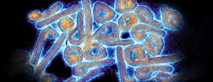 Researchers uncover mechanisms of protective antibody response during deadly Marburg virus infection