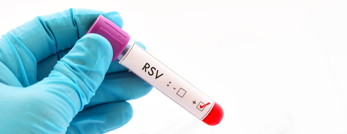 A virus with no vaccine, treatment is in the UTMB research crosshairs